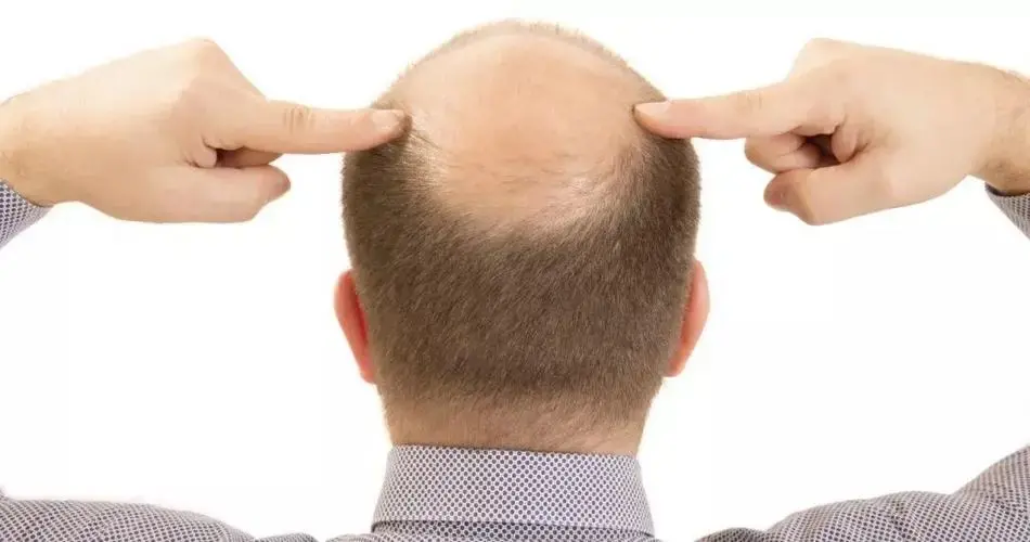 Was sollen wir gegen Haarausfall tun 